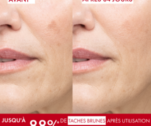 Vichy Liftactiv B3 Sérum anti-taches brunes
